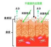 vinistyle教你掌控敏感肌，不做嬌氣“瓷娃娃”